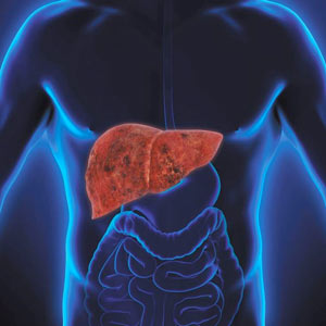 Raised Liver Enzymes & Fatty Liver